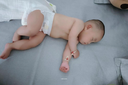 山南六个月宝宝眼睛散光